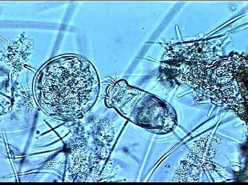 陽離子聚丙烯酰胺CPAM生產廠家—引起污泥膨脹的這些原因