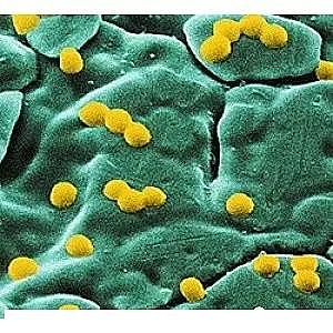 仁源水理材料氨氮去除劑廠家技術(shù)路線深入淺出談氨氮