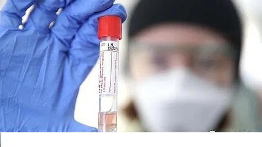 ú|(zh)w̿0.5-1mmSҰĴоˆT_l(f)zyˮCovid-19ϵy(tng)